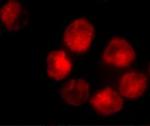 ADAM10 Antibody in Immunocytochemistry (ICC/IF)