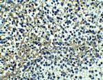 DR4 Antibody in Immunohistochemistry (Paraffin) (IHC (P))