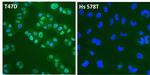 Estrogen Receptor alpha Antibody