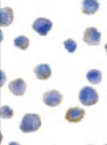 FLIP Antibody in Immunocytochemistry (ICC/IF)