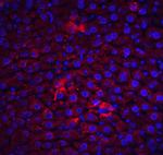 FLIP Antibody in Immunohistochemistry (Paraffin) (IHC (P))