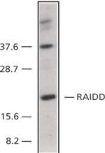 RAIDD Antibody in Western Blot (WB)