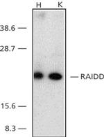 RAIDD Antibody in Western Blot (WB)