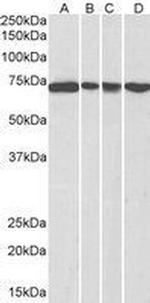 DDX5 Antibody in Western Blot (WB)