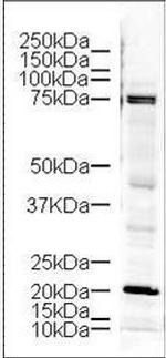 LIMK1 Antibody in Western Blot (WB)