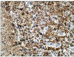 Calretinin Antibody in Immunohistochemistry (Paraffin) (IHC (P))