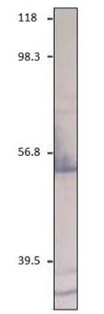 CXCR2 Antibody in Western Blot (WB)