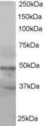 BAF53A Antibody in Western Blot (WB)