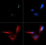 p14ARF Antibody in Immunocytochemistry (ICC/IF)