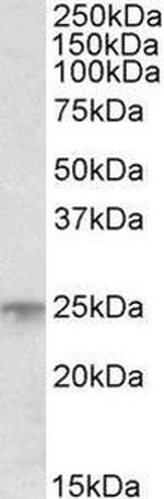 MSC Antibody in Western Blot (WB)