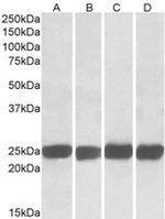 GRB2 Antibody in Western Blot (WB)