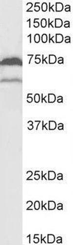 COX1 Antibody in Western Blot (WB)