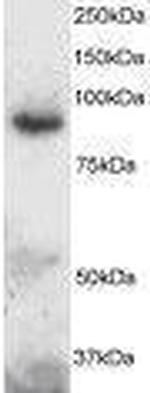 ADAM8 Antibody in Western Blot (WB)