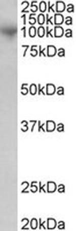 ADAM8 Antibody in Western Blot (WB)