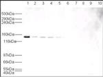 USP7 Antibody in Western Blot (WB)