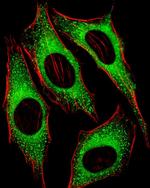 FGFR2 Antibody in Immunocytochemistry (ICC/IF)