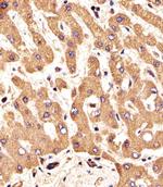 FGFR2 Antibody in Immunohistochemistry (Paraffin) (IHC (P))