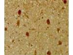 p130 Antibody in Immunohistochemistry (Paraffin) (IHC (P))