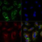 ABCA1 Antibody in Immunocytochemistry (ICC/IF)