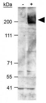 ABCA1 Antibody in Western Blot (WB)