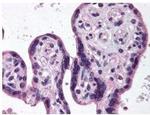 IKK beta Antibody in Immunohistochemistry (Paraffin) (IHC (P))