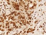 NuMA Antibody in Immunohistochemistry (Paraffin) (IHC (P))