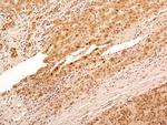 NuMA Antibody in Immunohistochemistry (Paraffin) (IHC (P))