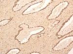 NuMA Antibody in Immunohistochemistry (Paraffin) (IHC (P))