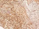 NuMA Antibody in Immunohistochemistry (Paraffin) (IHC (P))