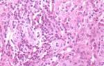 CXCR3 Antibody in Immunohistochemistry (Paraffin) (IHC (P))