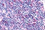 CXCR3 Antibody in Immunohistochemistry (Paraffin) (IHC (P))