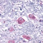 PTH2R Antibody in Immunohistochemistry (Paraffin) (IHC (P))