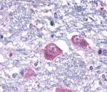 PTH2R Antibody in Immunohistochemistry (Paraffin) (IHC (P))