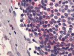 EDG6 Antibody in Immunohistochemistry (Paraffin) (IHC (P))