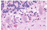 MTNR1B Antibody in Immunohistochemistry (Paraffin) (IHC (P))