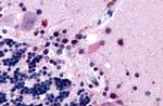 MTNR1B Antibody in Immunohistochemistry (Paraffin) (IHC (P))