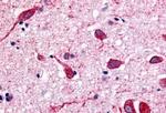 CHRM2 Antibody in Immunohistochemistry (Paraffin) (IHC (P))