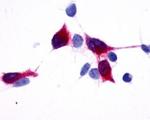 TPRA1 Antibody in Immunocytochemistry (ICC/IF)