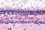 mGluR6 Antibody in Immunohistochemistry (Paraffin) (IHC (P))