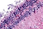 mGluR6 Antibody in Immunohistochemistry (Paraffin) (IHC (P))