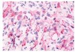 mGluR6 Antibody in Immunohistochemistry (Paraffin) (IHC (P))