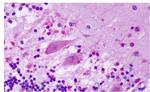 GPR1 Antibody in Immunohistochemistry (Paraffin) (IHC (P))