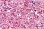 mGluR7 Antibody in Immunohistochemistry (Paraffin) (IHC (P))