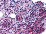 Calcium Sensing Receptor Antibody in Immunohistochemistry (Paraffin) (IHC (P))