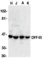 ICAD Antibody in Western Blot (WB)