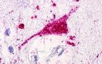 GPRC5D Antibody in Immunohistochemistry (Paraffin) (IHC (P))