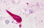 GPRC5D Antibody in Immunohistochemistry (Paraffin) (IHC (P))