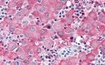 ADAMTS4 Antibody in Immunohistochemistry (Paraffin) (IHC (P))