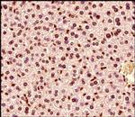 MECP2 Antibody in Immunohistochemistry (Paraffin) (IHC (P))