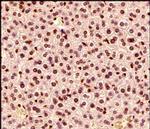 MECP2 Antibody in Immunohistochemistry (Paraffin) (IHC (P))